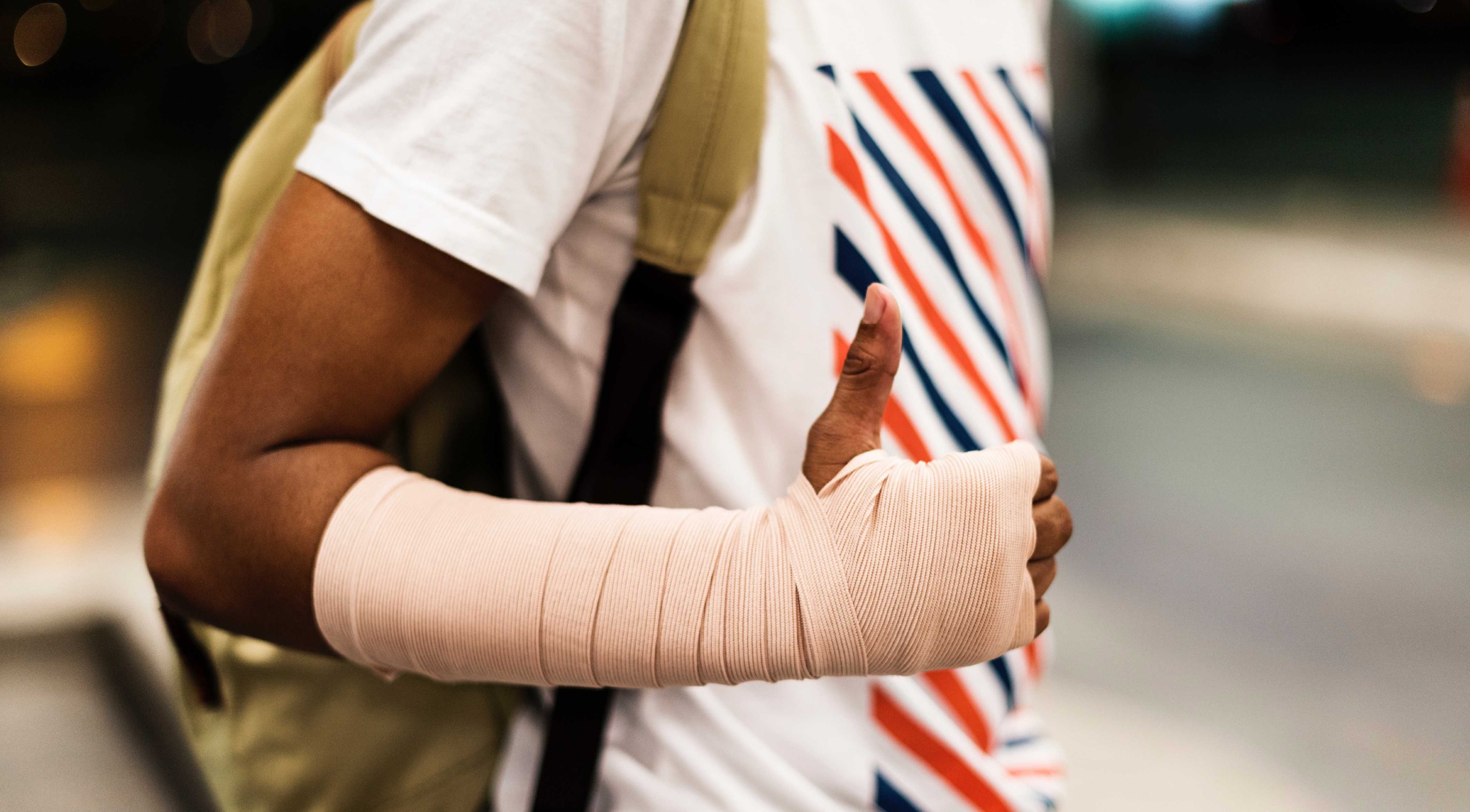 Nærbillede af en brækket arm af en bruger af hændelsesrapporteringsappen.
